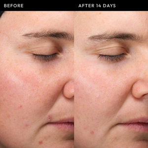 (Preorden) The INKEY List Exosome Hydro-Glow Complex Serum